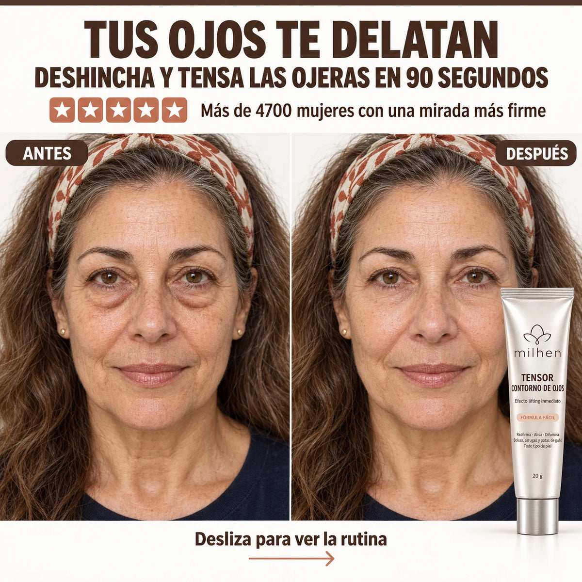 Antes y después: ojeras deshinchadas en 90 segundos