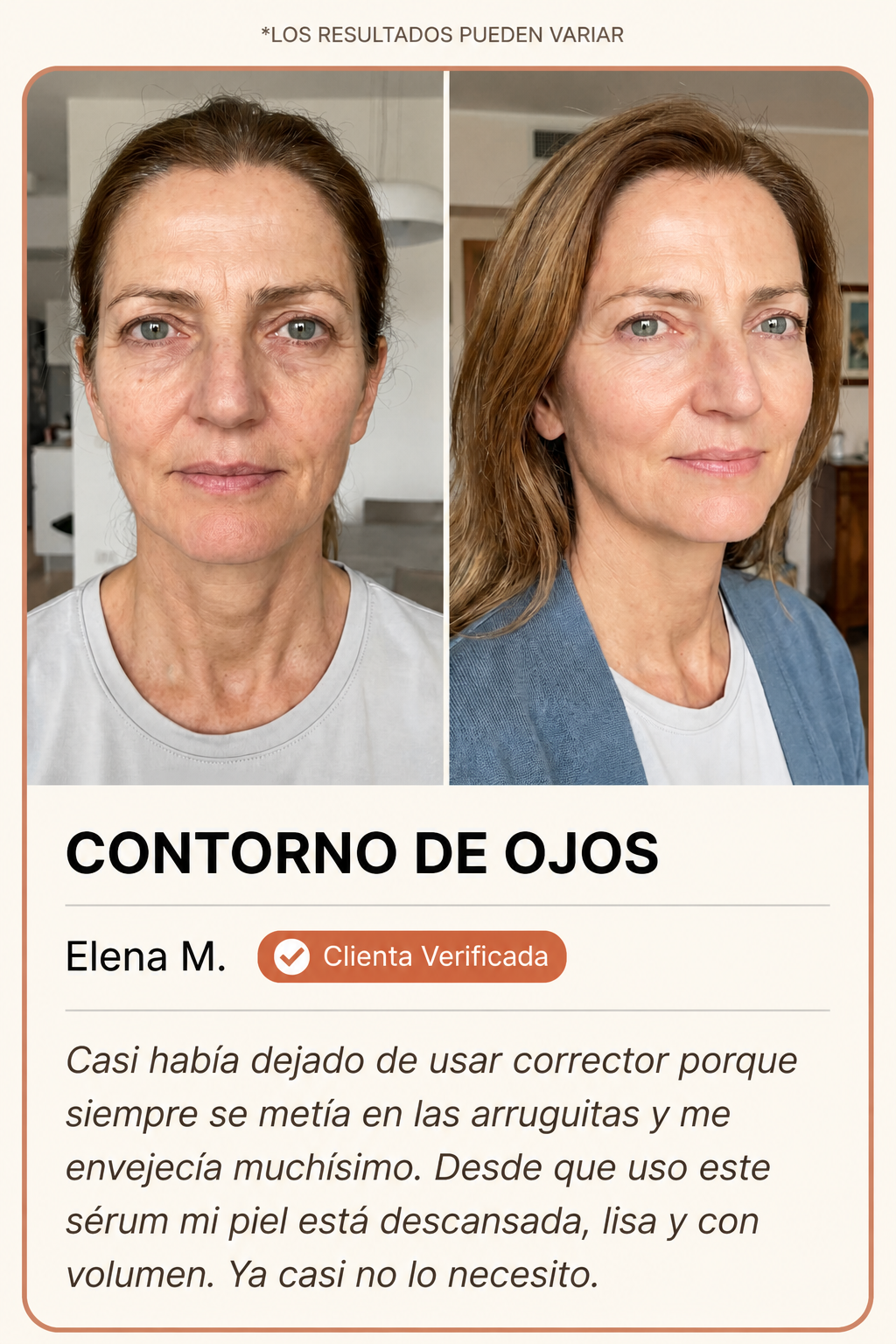 Contorno de ojos antes y después