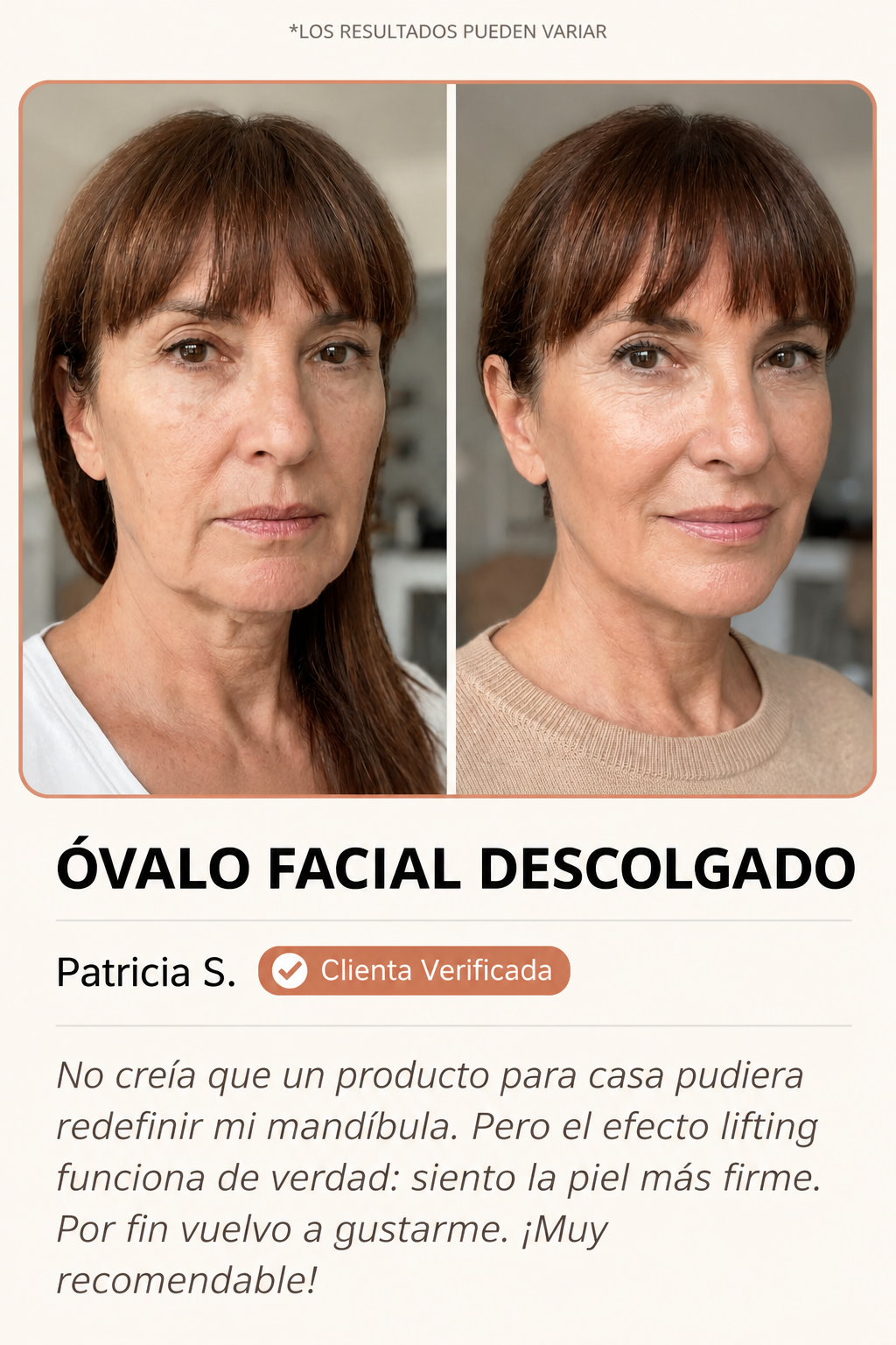 Óvalo facial antes y después