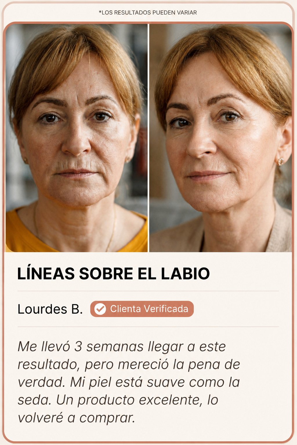 Líneas sobre el labio antes y después