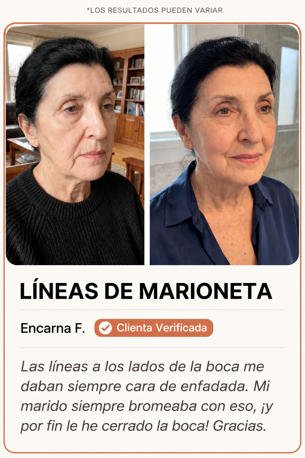 Líneas de marioneta antes y después