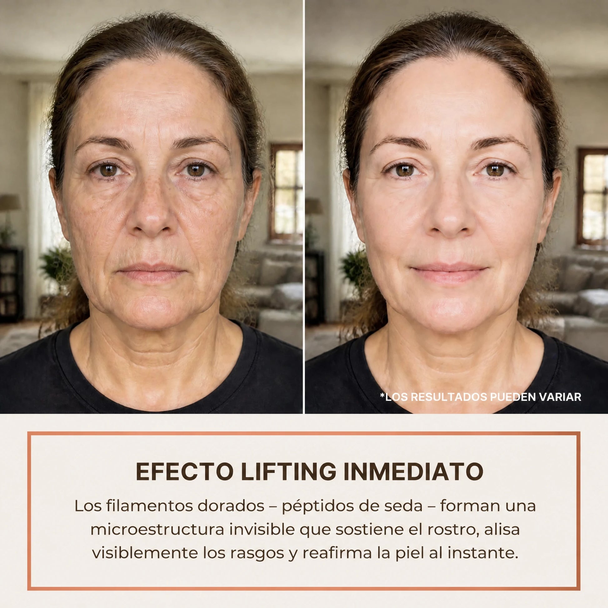 Efecto lifting inmediato: antes y después