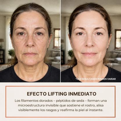 Efecto lifting inmediato: antes y después