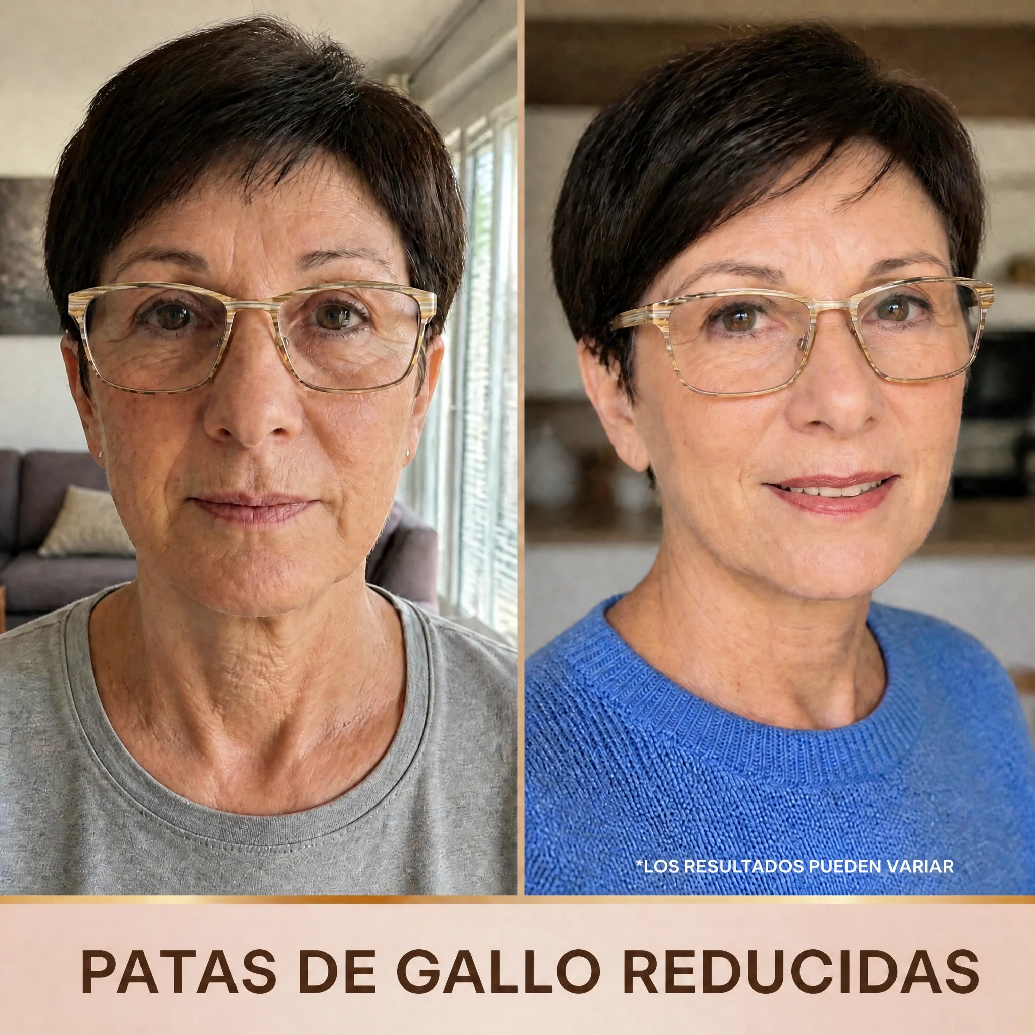 Patas de gallo reducidas: antes y después