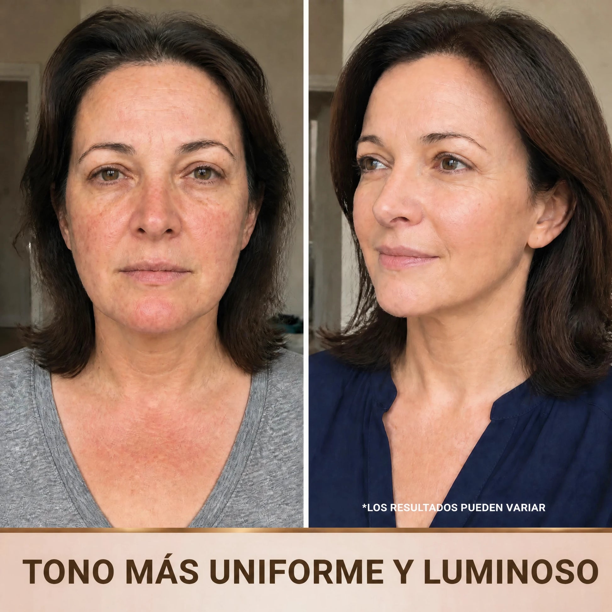 Tono más uniforme y luminoso: antes y después